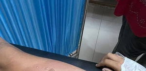 Imputan a hombre que derramó comida caliente sobre niña de 6 años - Noticiero Paraguay