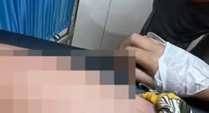 Niña quemada con comida caliente tiene daños en el 16% del cuerpo - Noticiero Paraguay
