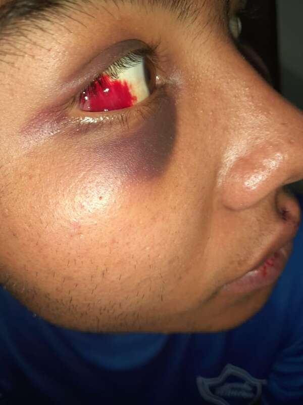 Ayolas: denuncian a Grupo Lince por supuesto hecho de tortura - Nacionales - ABC Color