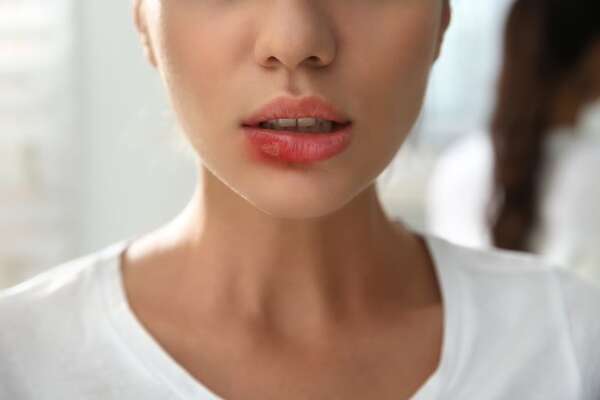 Infección por virus del herpes labial podría influir en el desarrollo del alzhéimer - Ciencia - ABC Color