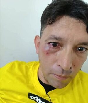 Dirigentes molieron a golpes a un árbitro por cobrar una falta