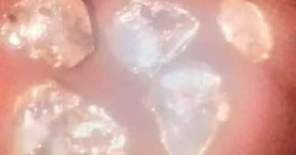 Diario HOY | Cavaron pozos buscando agua, pero hallaron oro en varias zonas de Caapucú
