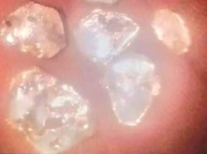 Buscaban agua y encontraron oro en Caapucú - Portal Digital Cáritas Universidad Católica