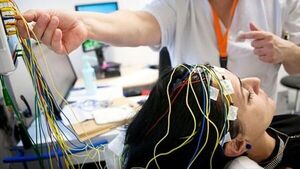 Alertan que ataques de epilepsia no siempre aparecen como convulsiones