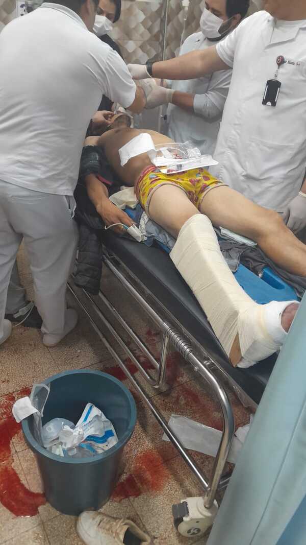 Motochorros asaltan farmacia y pizzería, huyen y uno muere tras ser atropellados durante la fuga - La Clave