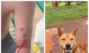 ¡Niño de 8 años fue atacado por un perro en Encarnación!