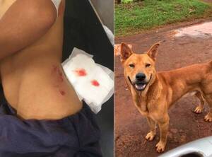 Una criatura que andaba en bici fue violentamente atacado por un perro: le dejó heridas muy feas