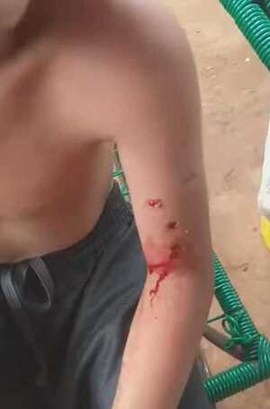 Perro atacó a un niño y lo hirió en el barrio Chaipé de Encarnación - 1000 Noticias