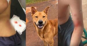 Diario HOY | Otro caso de ataque canino, ahora en Encarnación: víctima fue un niño