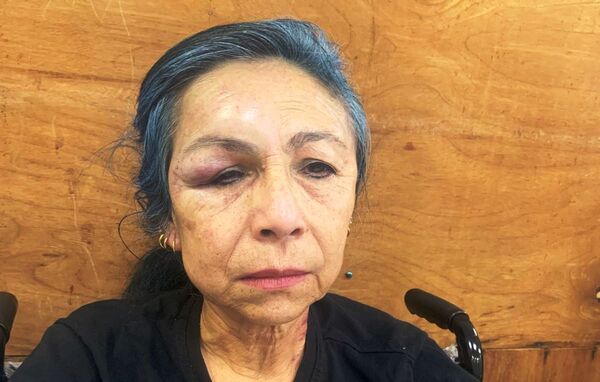 Una enfermera sufre brutal asalto en su propia casa •