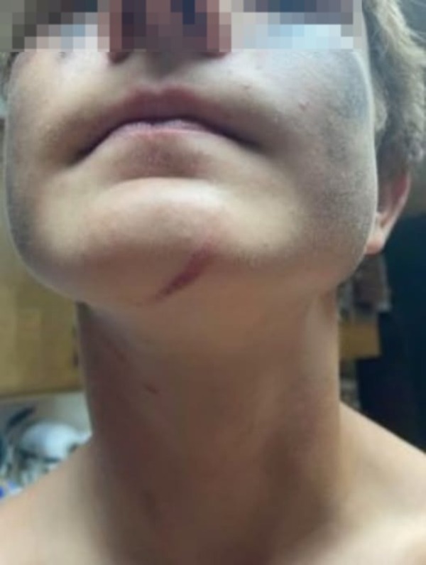 Solicitan rebeldía de un hombre que intentó estrangular a su hijo pequeño - 1000 Noticias