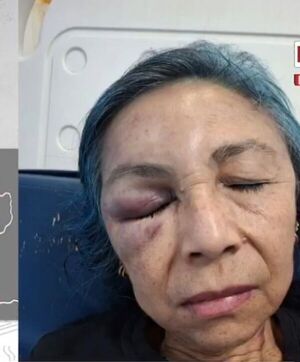 (VIDEO) Doña fue sopapeada, maniatada y asfixiada por delincuentes que querían robarles