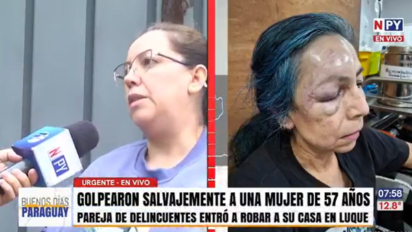 Enfermera brutalmente agredida por pareja de delincuentes en violento asalto domiciliario en Luque