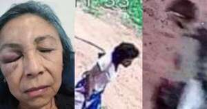 Diario HOY | Enfermera sufre brutal ataque de pareja de adictos que entró a robar a su casa