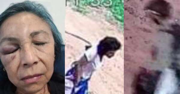 Diario HOY | Enfermera sufre brutal ataque de pareja de adictos que entró a robar a su casa