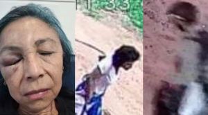 Enfermera sufre brutal ataque de pareja de adictos que entró a robar a su casa - Noticiero Paraguay