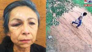 ¡Horror en Luque! Mujer de 57 fue garroteada y maniatada por adictos en su propia casa