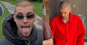 La Nación / Justin Bieber sufre la peor alopecia ¿se quedará calvo?