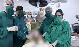 Exitosa primera cirugía urológica en el Hospital Distrital de Caaguazú – Prensa 5