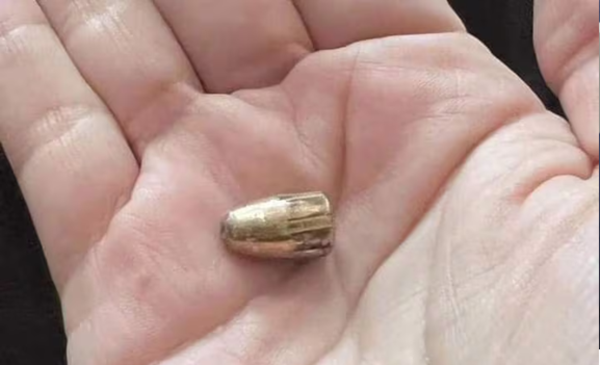 Concepción: una mujer resultó herida por una bala perdida mientras dormía
