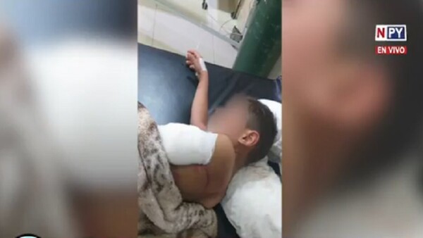 Niño fue atacado por un perro en Encarnación