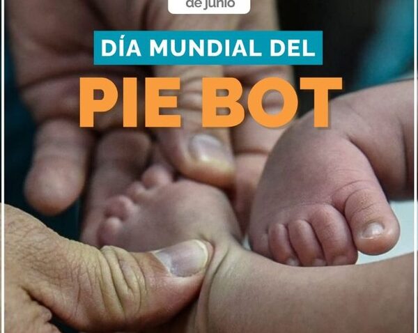 Día Mundial del Pie Bot: más de 200 niños reciben tratamiento anual en hospitales públicos