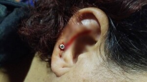 Doña quedó con la oreja perforada tras ataque a un colectivo interno