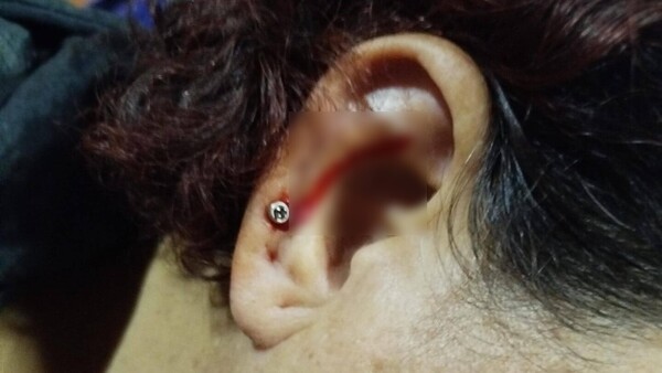 Doña quedó con la oreja perforada tras ataque a un colectivo interno