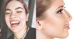 La Nación / “Enaltece mi cara”: Chenny TV resalta su nariz y descarta rinoplastia
