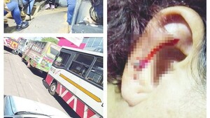 Una pasajera herida en protesta: “Pudo haber sido mi ojo”, lamentó