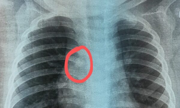 (Video) En Inerán convocan a médico, ¡pero mirá el giro inesperado de la urgencia!