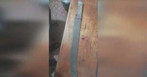 Diario HOY | Mujer fue agredida con machete, puños y una pata de cabra