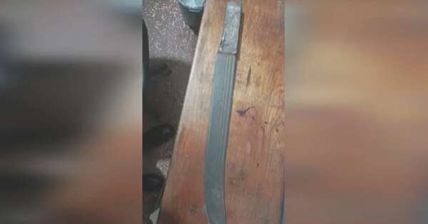 Diario HOY | Mujer fue agredida con machete, puños y una pata de cabra