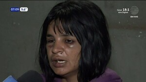 Mujer denuncia brutal agresión por parte de su ex pareja en San Lorenzo