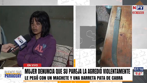 Mujer sobrevive a brutal agresión de su expareja: “Pensé que iba a morir”