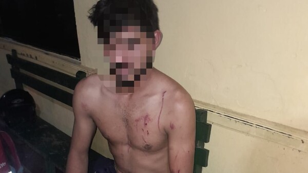 Lapa le macheteó por llegar tarde a su casa