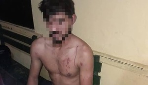 Hombre denuncia a su pareja por agresión física y verbal en Limpio