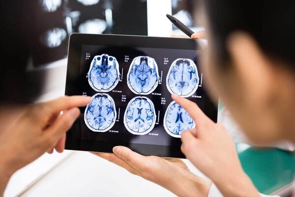 Tumor cerebral y sus signos de alerta: detección temprana marca diferencias - Nacionales - ABC Color