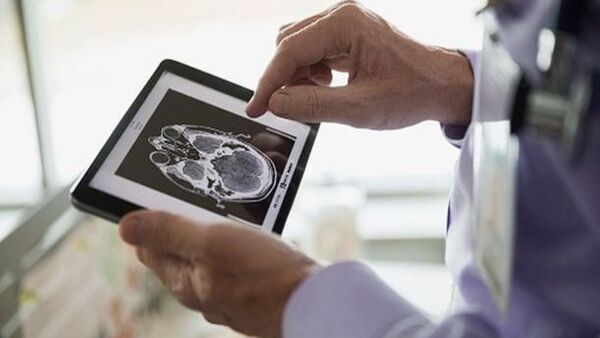 Observan cambios cerebrales en personas con síndrome de Down 15 años antes de aparecer el alzhéimer