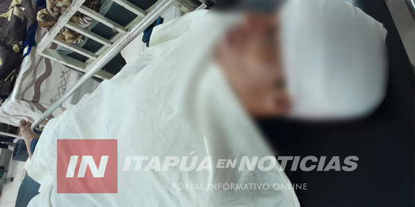 JOVEN FUE APUÑALADO EN LA CABEZA EN CAMBYRETÁ