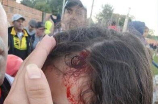 Versus / Vándalos hieren a una criatura durante una pelea en la Liga Iteña