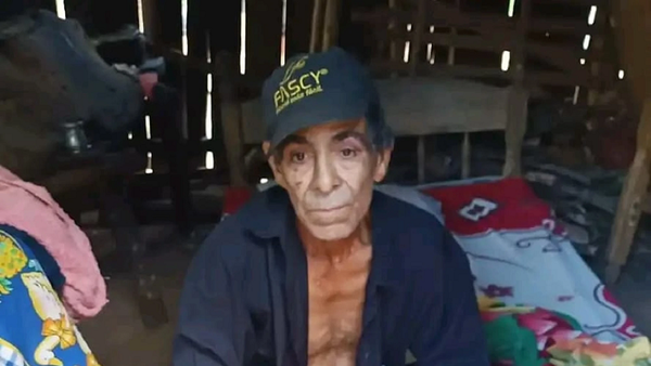 Muere el hombre que había sido atacado por su hijo - Noticiero Paraguay