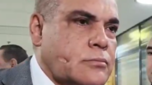 ¿Qué le pasó a Bachi Núñez en la cara? Quieren saber quién es su cirujano