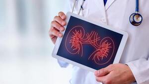 Señales silenciosas que podrían esconder un cáncer de riñón
