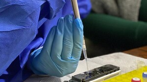 Cerebros paraguayos hallan clave para monitorear tratamiento de tuberculosis