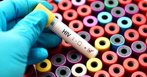 Diario HOY | Un gran paso contra el VIH: en Paraguay se celebra el avance, pero preocupan las cifras