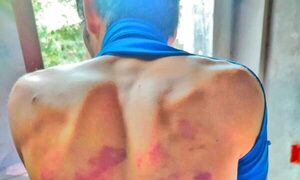 Expoli molió a golpes a un presunto ladrón y su madre denuncia que podría quedar parapléjico