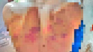 Lo confundieron con un ladrón y lo molieron a golpes