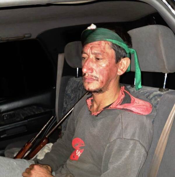 Hombre mató a su compañero de trabajo tras ser atacado con machete y amenazado con escopeta - La Clave