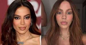 La Nación / ¡Impactante cambio! Anitta reaparece con un nuevo rostro